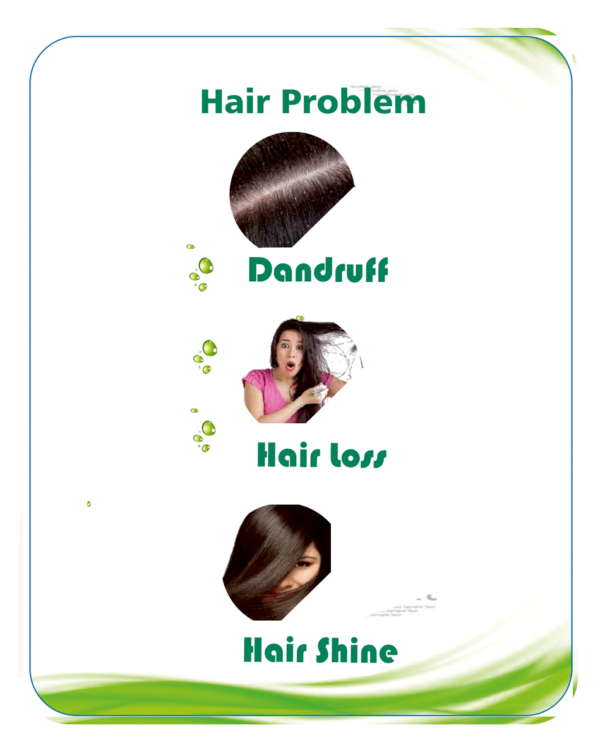 Simiyo Anti Dandruff Lotion - Image 2